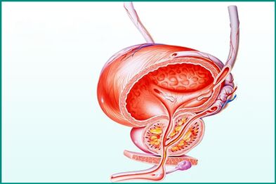 Inflamația prostatei în prostatita acută este o limitare pentru sex