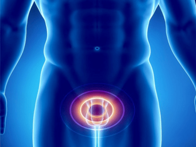 Prostatita - inflamație a glandei prostatei la un bărbat